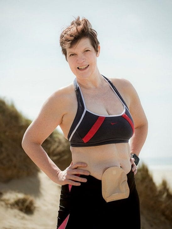 Woman in 50s short brown hair sports crop top black and red hands on hips black shorts showing stoma bag